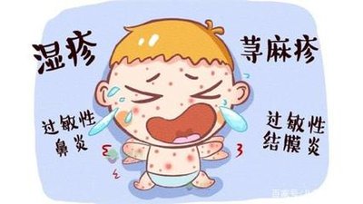 春季，过敏高发期，过敏体质宝宝有哪些症状?