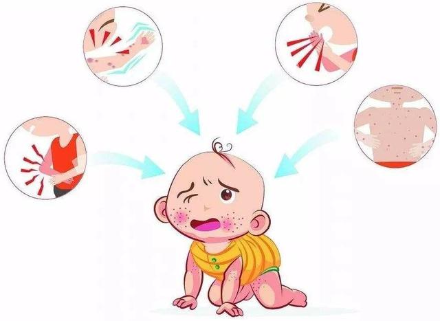 干货|5大春季儿童高发病防控早知道！